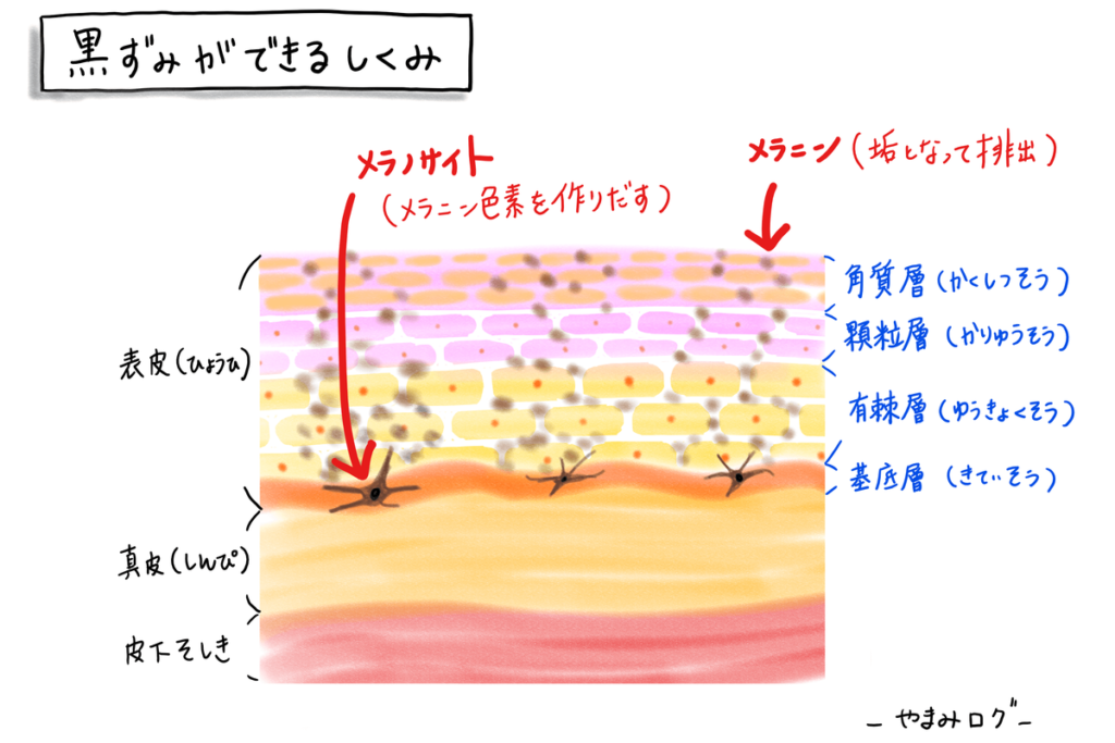 黒ずみができるしくみ　肌断面図