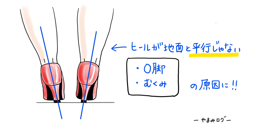 姿勢が悪い　イラスト　ヒールが曲がっている　O脚やむくみの原因になる