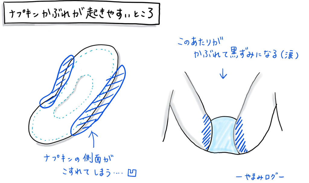 ナプキン かぶれ 痛い